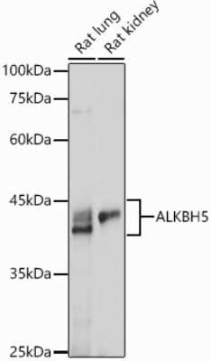 Western Blot: ALKBH5 Antibody [NBP2-92048] - Western blot analysis of extracts of various cell lines, using ALKBH5 antibody (NBP2-92048) at 1:1000 dilution. Secondary antibody: HRP Goat Anti-Rabbit IgG (H+L) at 1:10000 dilution. Lysates/proteins: 25ug per lane. Blocking buffer: 3% nonfat dry milk in TBST. Detection: ECL Basic Kit. Exposure time: 180s.